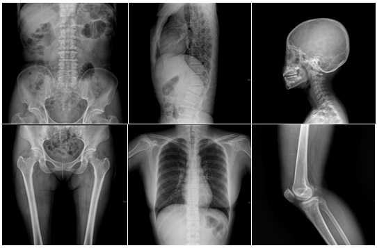 Radiología o Diagnóstico por imagen